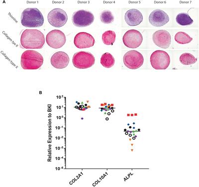 Angiogenic Potential of Tissue Engineered Cartilage From Human Mesenchymal Stem Cells Is Modulated by Indian Hedgehog and Serpin E1